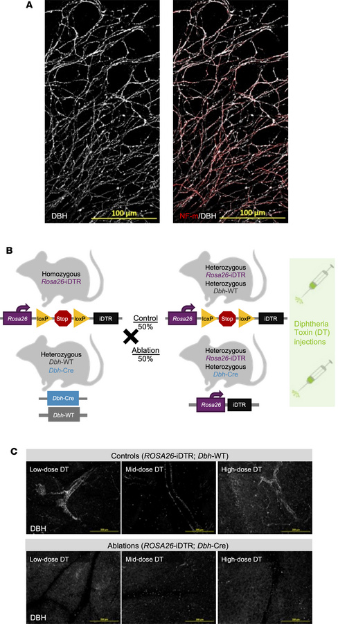 Pancreas-specific genetic ablation of sympathetic innervation.
(A) Repre...