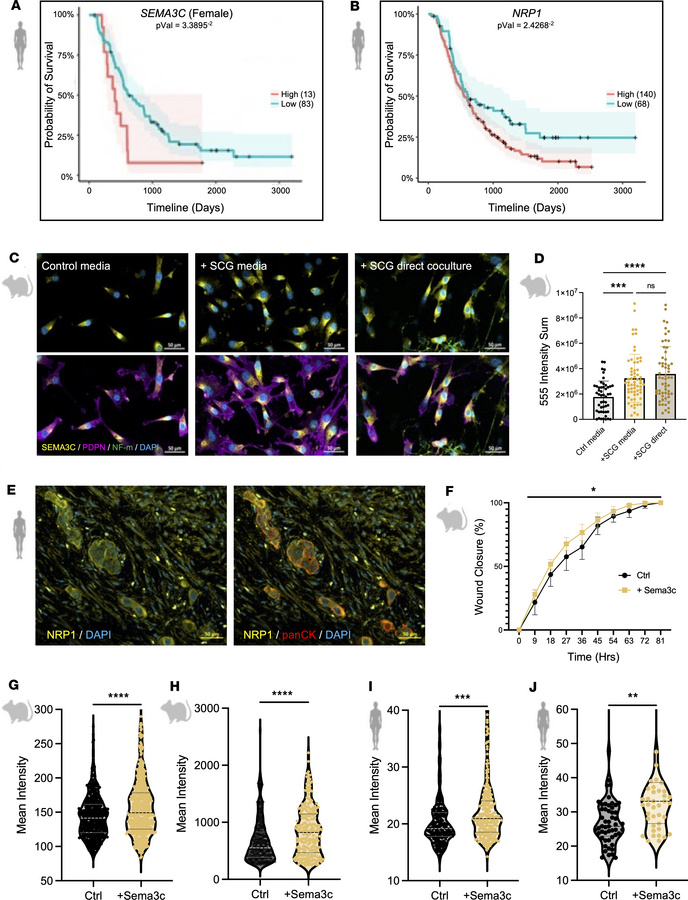 Upregulation of Sema3c enhances metastatic phenotypes.
(A and B) Kaplan-...