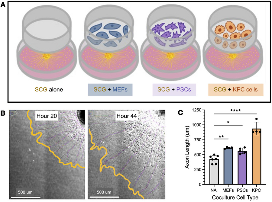 Cancer and fibroblast signaling enhances SCG axon outgrowth.
(A) Schemat...