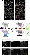 Pancreas-specific genetic ablation of sympathetic innervation.