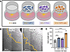 Cancer and fibroblast signaling enhances SCG axon outgrowth.