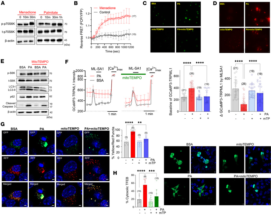 Scavenging mitochondrial superoxide prevents palmitate-induced TRPML1 in...