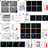 Palmitate induces autophagy defects mediated by mTORC1 activation at lysoso