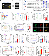 Palmitate elevates perilysosomal Ca2+ level and inhibits TRPML1-mediated ly