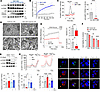 Inhibiting mTORC1 abolishes palmitate-induced TRPML1 suppression and autoph