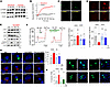 Scavenging mitochondrial superoxide prevents palmitate-induced TRPML1 inhib