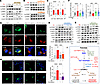 Reducing Ca2+ influx attenuates palmitate-induced mTORC1 activation and aut