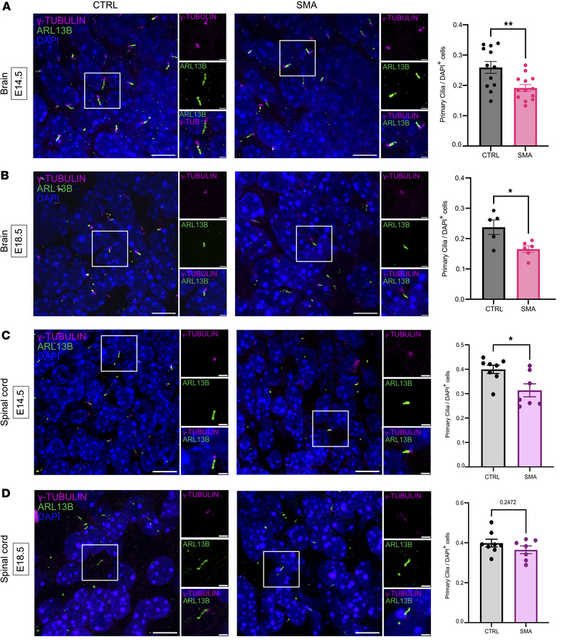 Reduced density of primary cilia in the SMA mouse embryonic hippocampus ...
