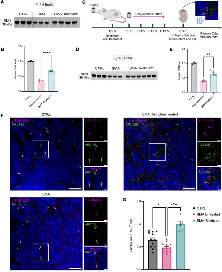 Reduced density of primary cilia in the SMA mouse embryonic hippocampus ...