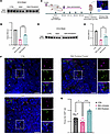 Reduced density of primary cilia in the SMA mouse embryonic hippocampus is