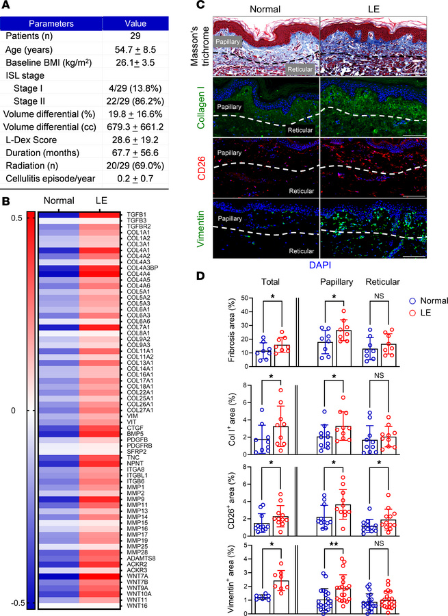 Lymphedema induces skin fibrosis in patients with unilateral BCRL.
(A) P...