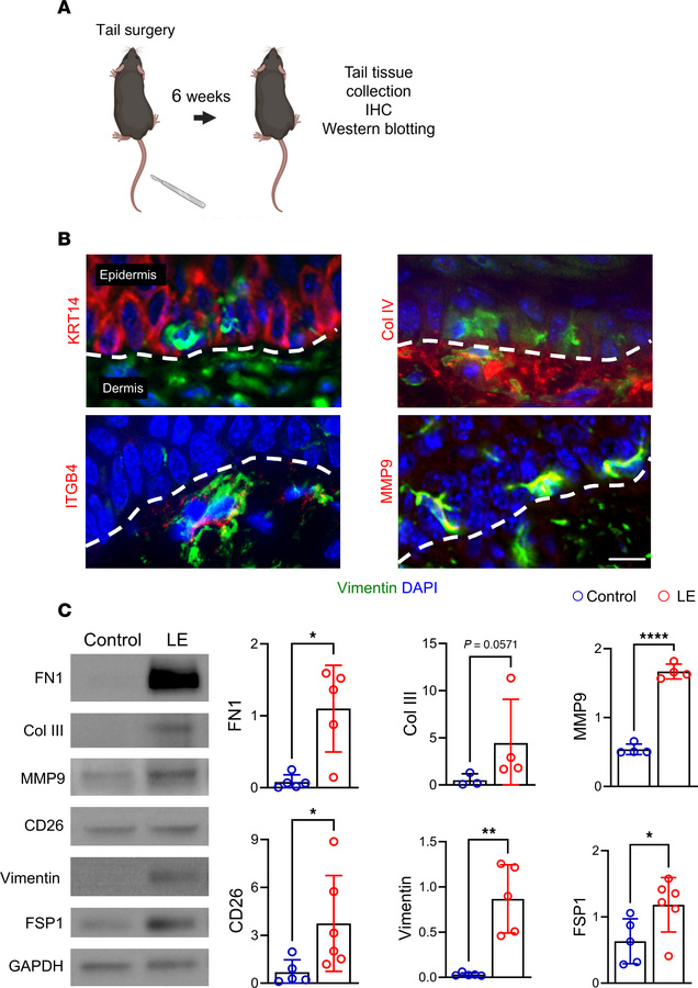 Mouse tail lymphedema induces EMT, mirroring human pathology.
(A) Schema...