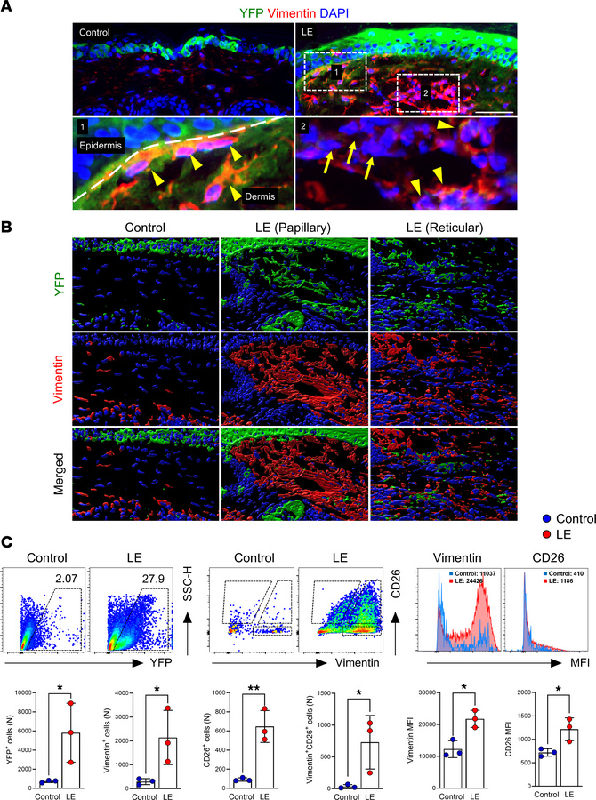Lineage tracing confirms keratinocyte-derived fibroblasts in lymphedemat...