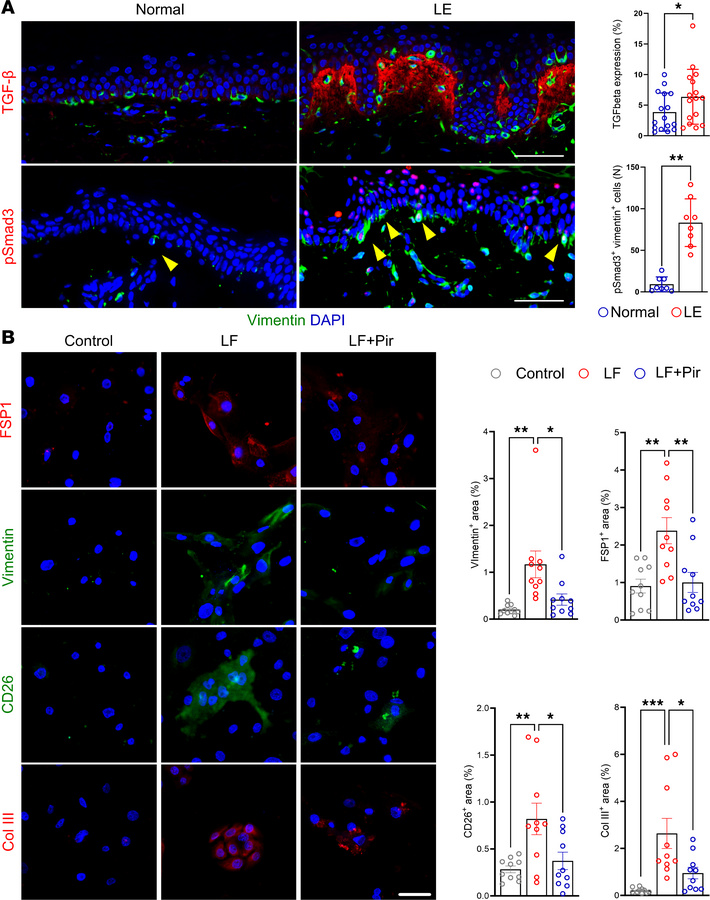 TGF-β signaling drives keratinocyte EMT in lymphedema, both in vivo and ...