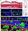 Lymphedema disrupts epidermal architecture and induces vimentin expression