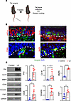 Mouse tail lymphedema induces EMT, mirroring human pathology.
