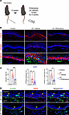 Topical pirfenidone reduces TGF-β signaling and keratinocyte EMT in lymphed