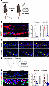 Th2 cytokine inhibition decreases TGF-β signaling and keratinocyte EMT in l