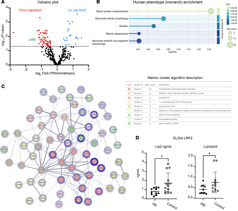 Analysis of proteins in the vitreous of myopic and emmetropic patients.
...
