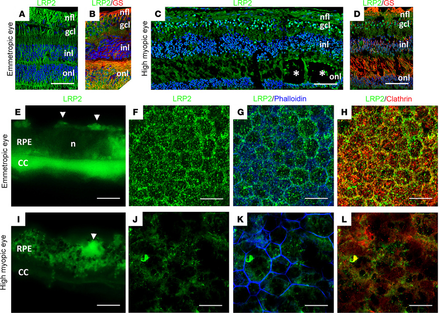 LRP2 immunolabeling in the emmetropic and HM retina.
(A and B) In the em...