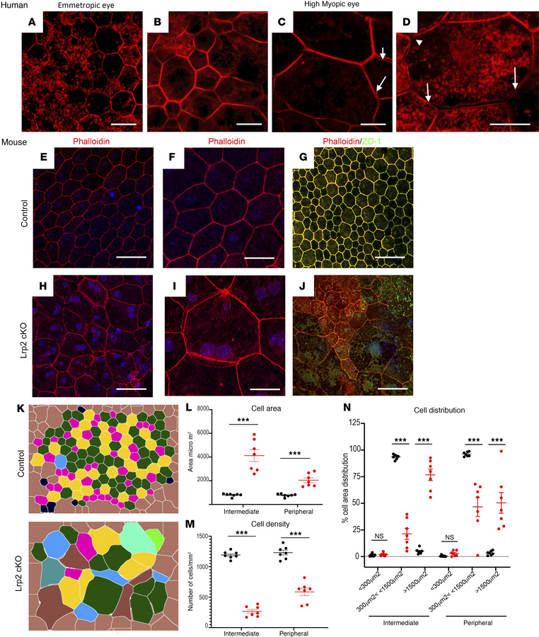 Organization of the RPE is altered in HM eye, similar to the RPE in Lrp2...