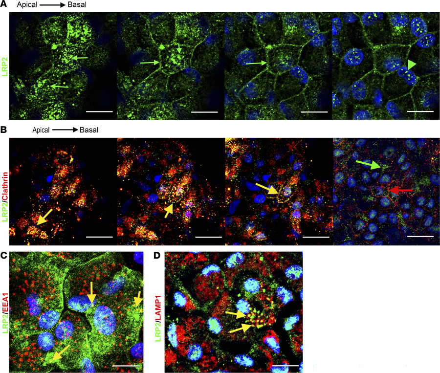 LRP2 localization in healthy human iRPE.
(A) Consecutive confocal images...