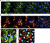 LRP2 localization in healthy human iRPE.
