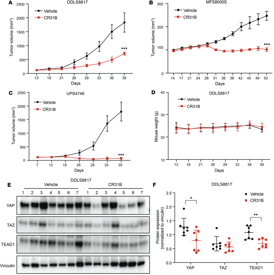 [-]CR-1-31B suppresses tumor growth of DDLS, MFS, and UPS xenografts.
(A...