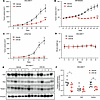 [-]CR-1-31B suppresses tumor growth of DDLS, MFS, and UPS xenografts.