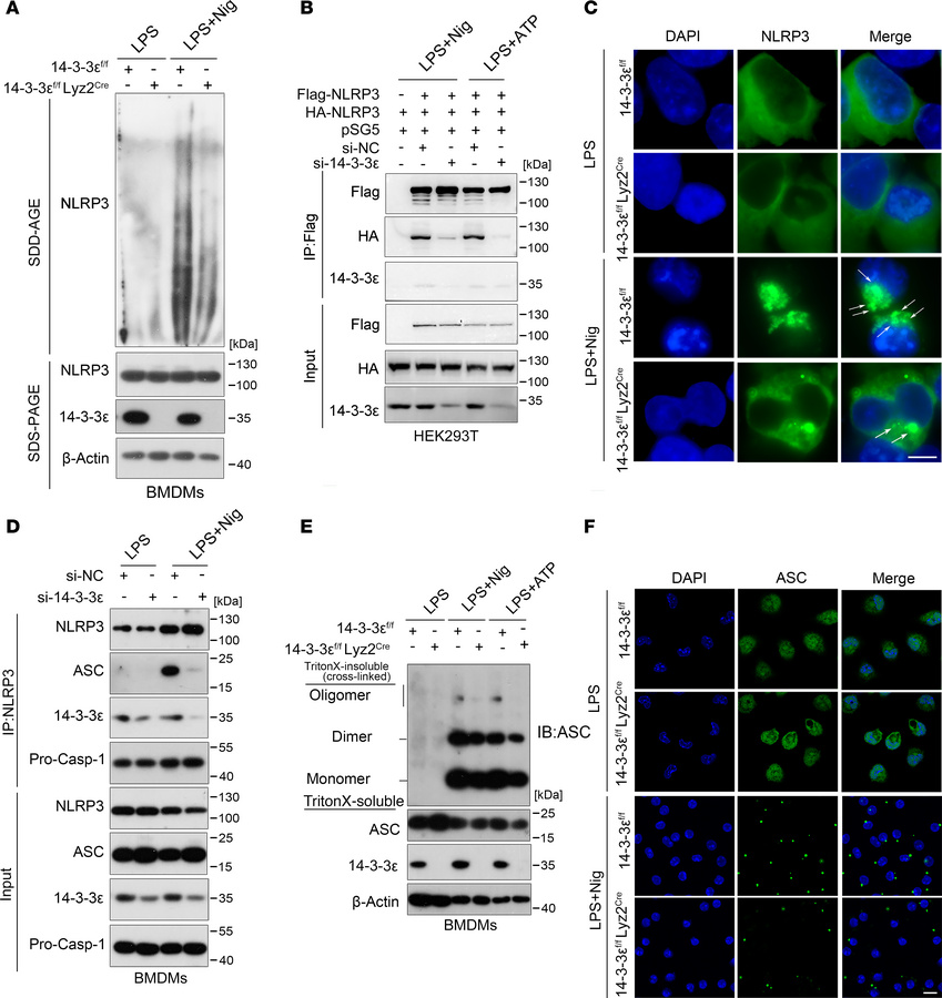 14-3-3ε facilitates the assembly of the NLRP3 inflammasome.
(A) BMDMs fr...