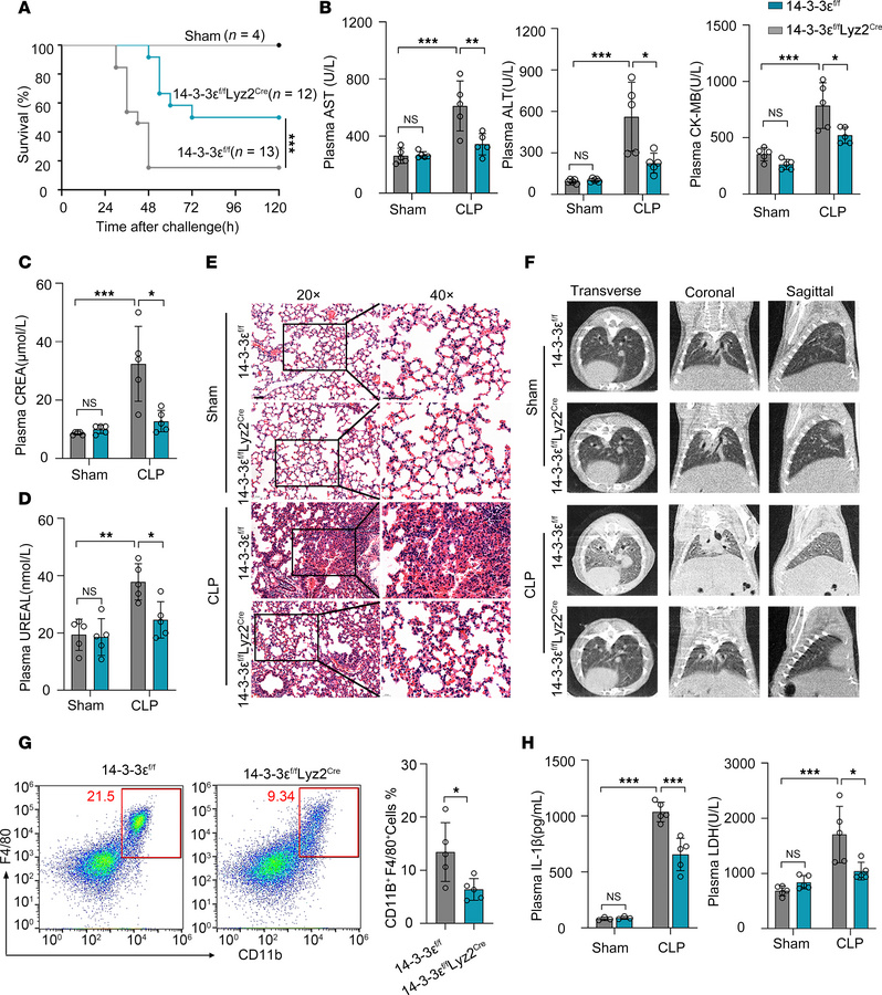 14-3-3ε deficiency in myeloid cells reduces organ damage and inflammator...