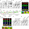 14-3-3ε promotes the translocation of NLRP3 proteins to mitochondria-associ