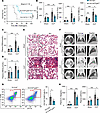 14-3-3ε deficiency in myeloid cells reduces organ damage and inflammatory i