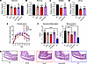 Additional Fc tag engineering improves Ig1&2-Fc effect in vivo.