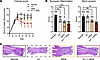 Combination treatment with Ig1&2-Fc and mTnfr2 improves therapeutic effect