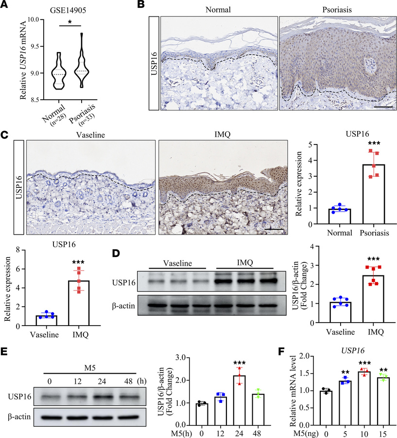 USP16 is upregulated in both psoriatic skin and in IMQ-induced psoriasis...