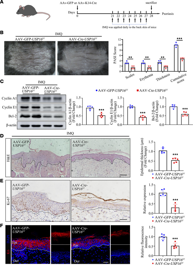 USP16 ablation in keratinocytes ameliorates the psoriasiform phenotype.
...