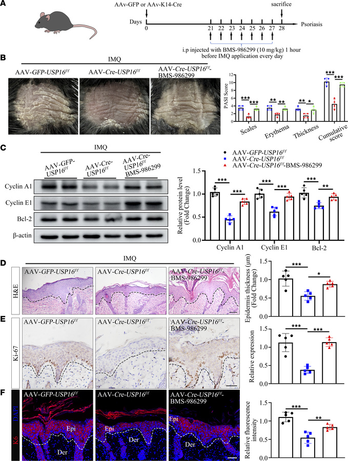 The psoriasis alleviation driven by USP16 knockdown depends on NLRP3.
(A...