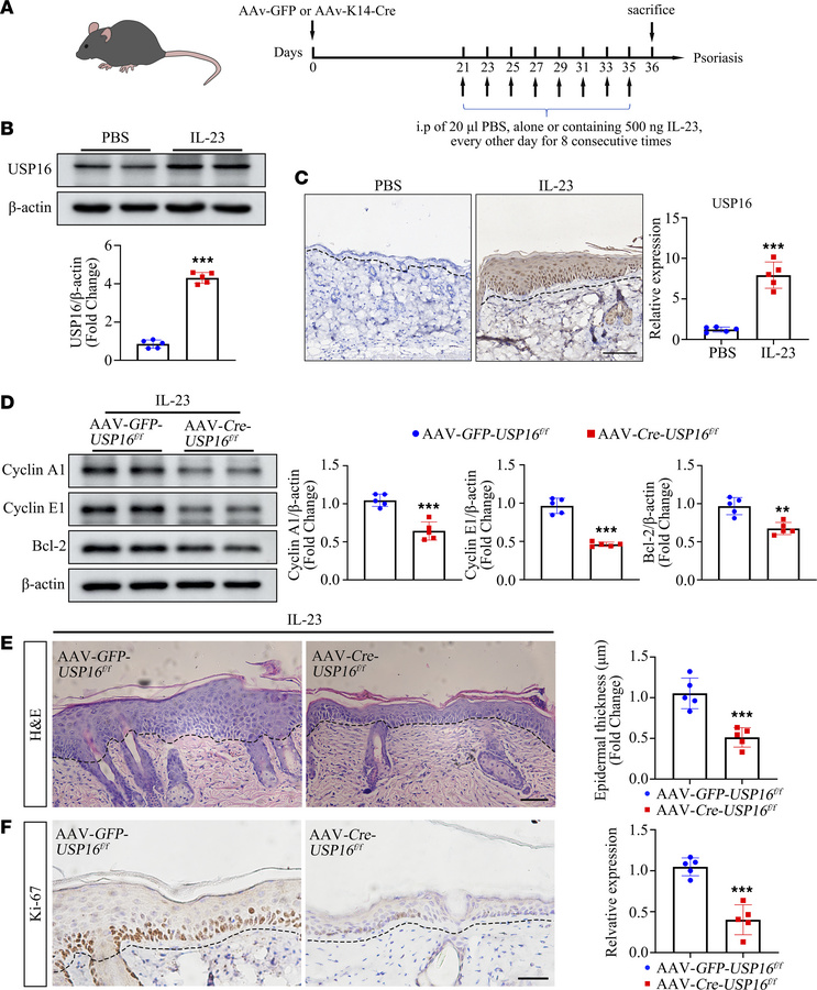 Keratinocyte-specific knockdown of USP16 alleviates IL-23–induced psoria...