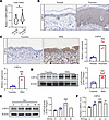 USP16 is upregulated in both psoriatic skin and in IMQ-induced psoriasis mo