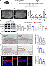 USP16 ablation in keratinocytes ameliorates the psoriasiform phenotype.