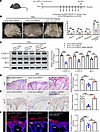 The psoriasis alleviation driven by USP16 knockdown depends on NLRP3.