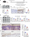 Keratinocyte-specific knockdown of USP16 alleviates IL-23–induced psoriasis