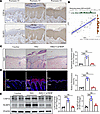 The expression of USP16 in psoriasis has been found to not only correlate w