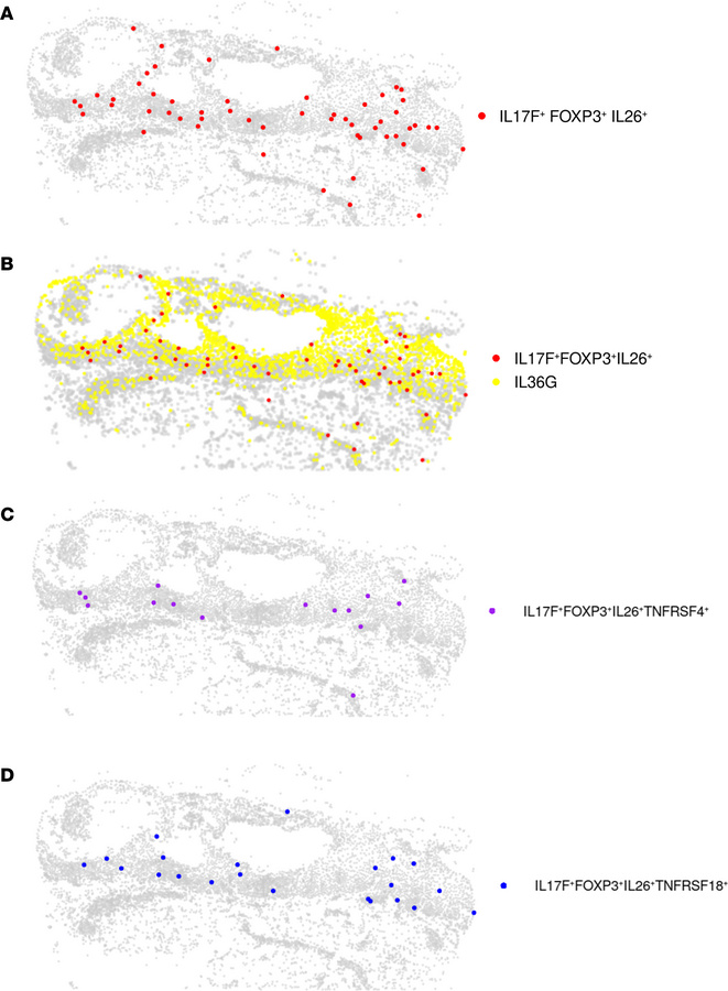 CosMX spatial analysis confirmed regulatory Th17 cells as a key driver o...
