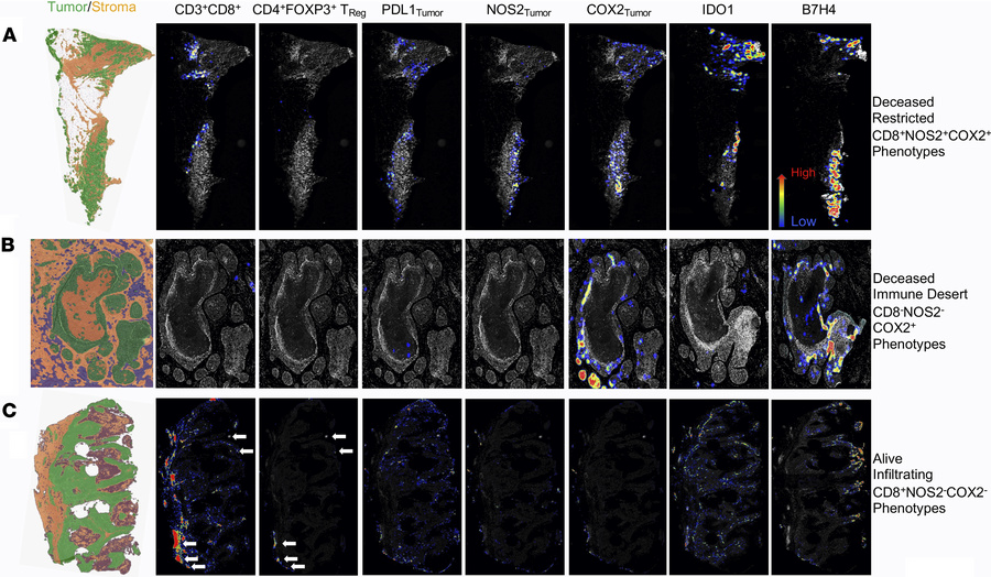 Density heatmap distributions of immunosuppressive TReg, PDL1, IDO1, B7H...