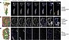 Density heatmap distributions of immunosuppressive TReg, PDL1, IDO1, B7H4,
