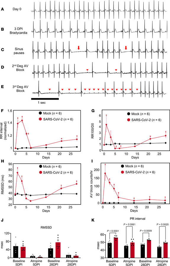 Effects of SARS-CoV-2 infection on cardiac electrophysiology in the hams...
