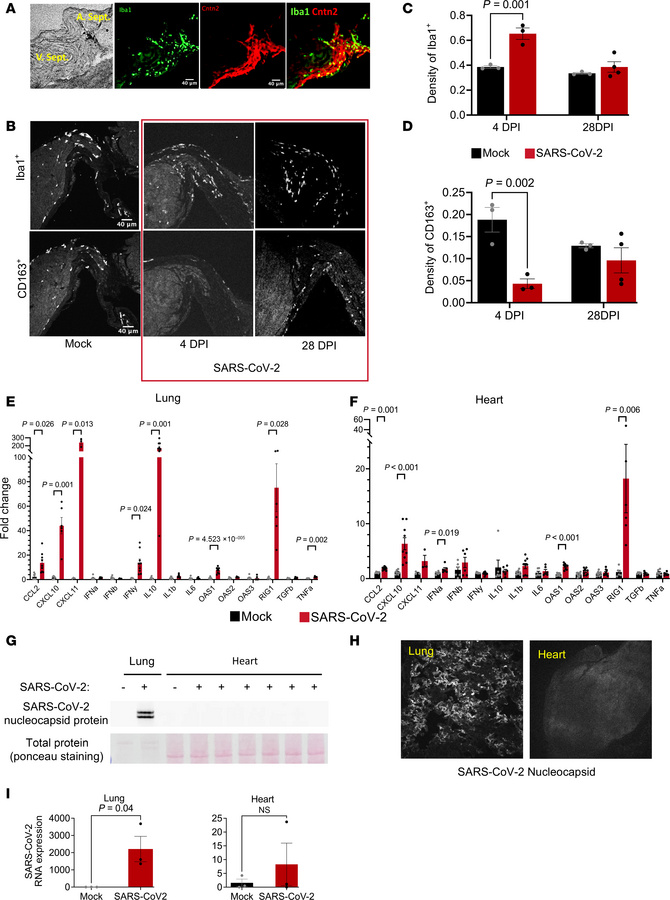 Macrophage remodeling in the CCS.
(A) Representative images showing the ...