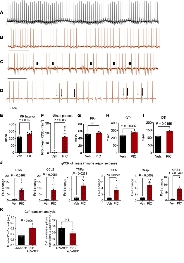 The dsRNA mimetic PIC induces cardiac arrhythmias and innate immune resp...